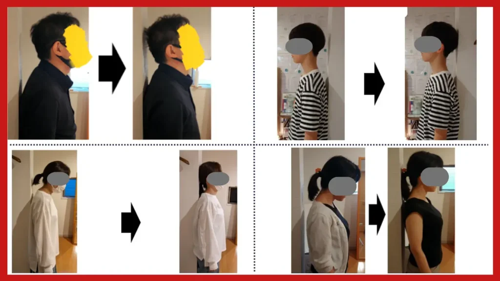 薬を飲んでも良くならない不調の背景にある首の緊張についての説明