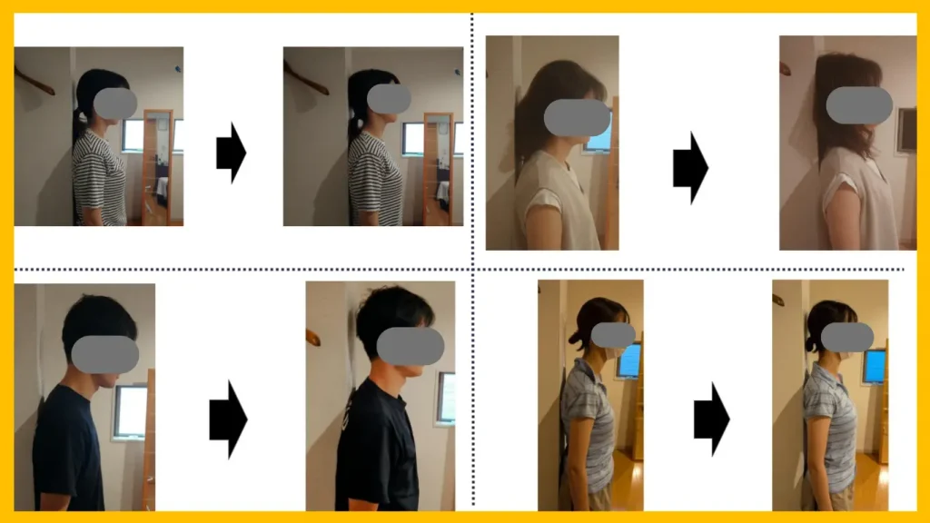 自律神経の不調改善に向けた施術の考え方 心と体を両方から整えるアプローチ