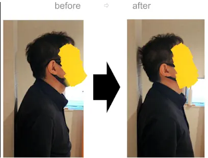 施術後の状態確認 専用の鏡と写真で変化を一緒に確認する様子