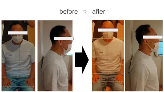 施術前後の姿勢比較 ビフォーアフターの確認画像